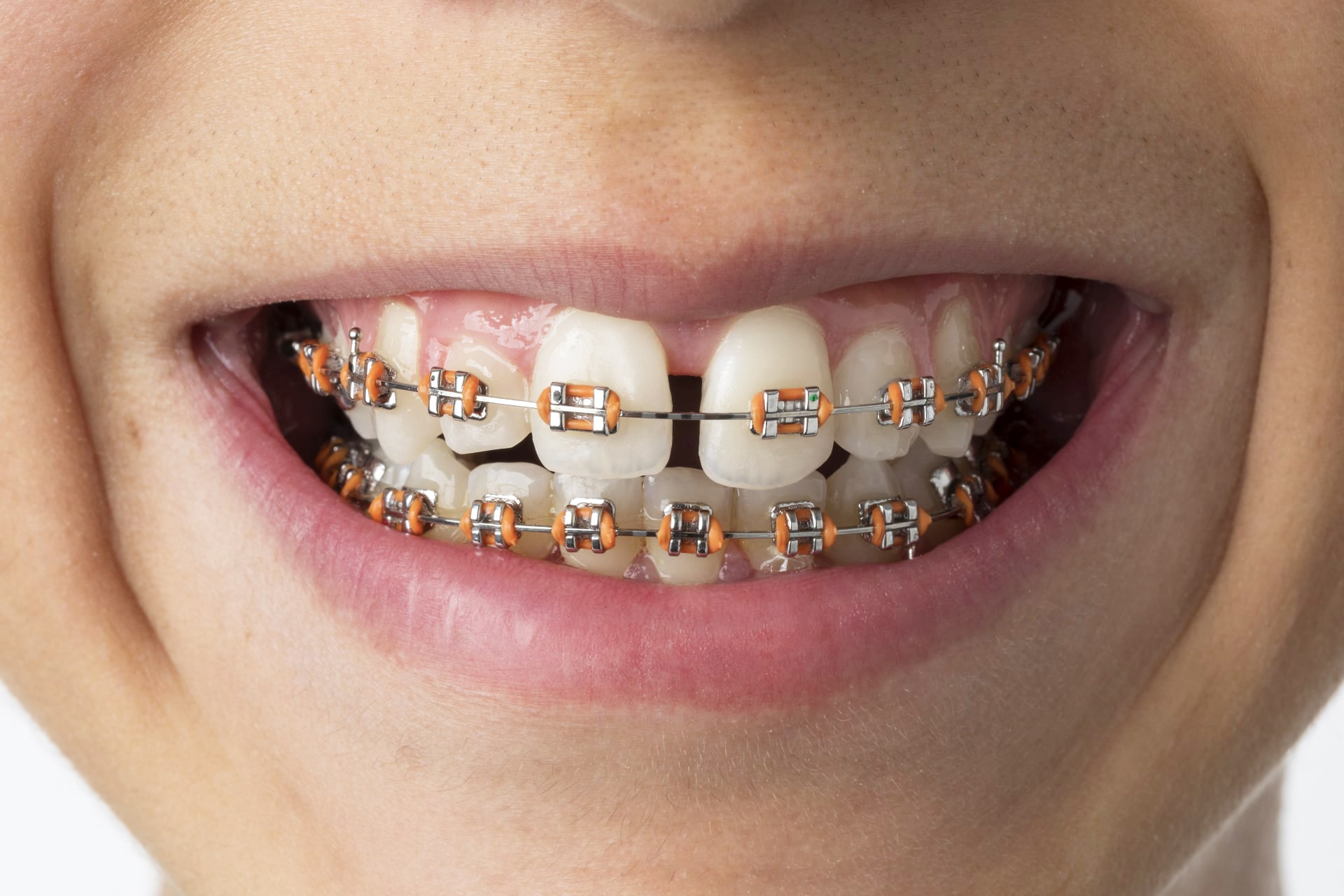 Knoxville Orthodontist